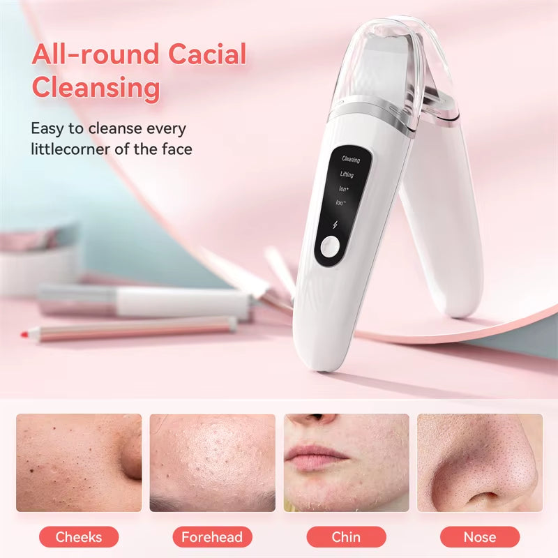Ultrasonic Facial Skin Scrubber & Blackhead Remover – Deep Pore Cleansing Spatula Exfoliator for Glowing, Smooth Skin”