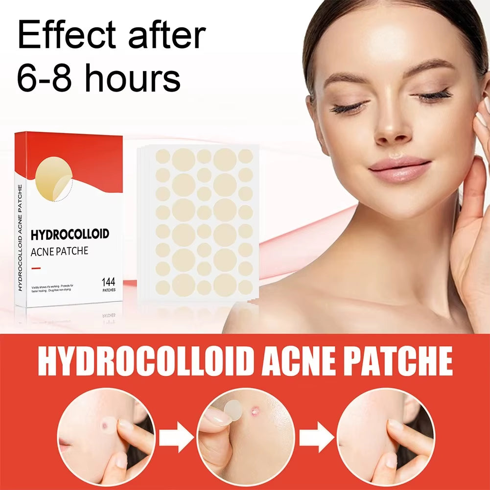 Invisible Hydrocolloid Acne Patches – Fast-Healing, Anti-Inflammatory Spot Treatment