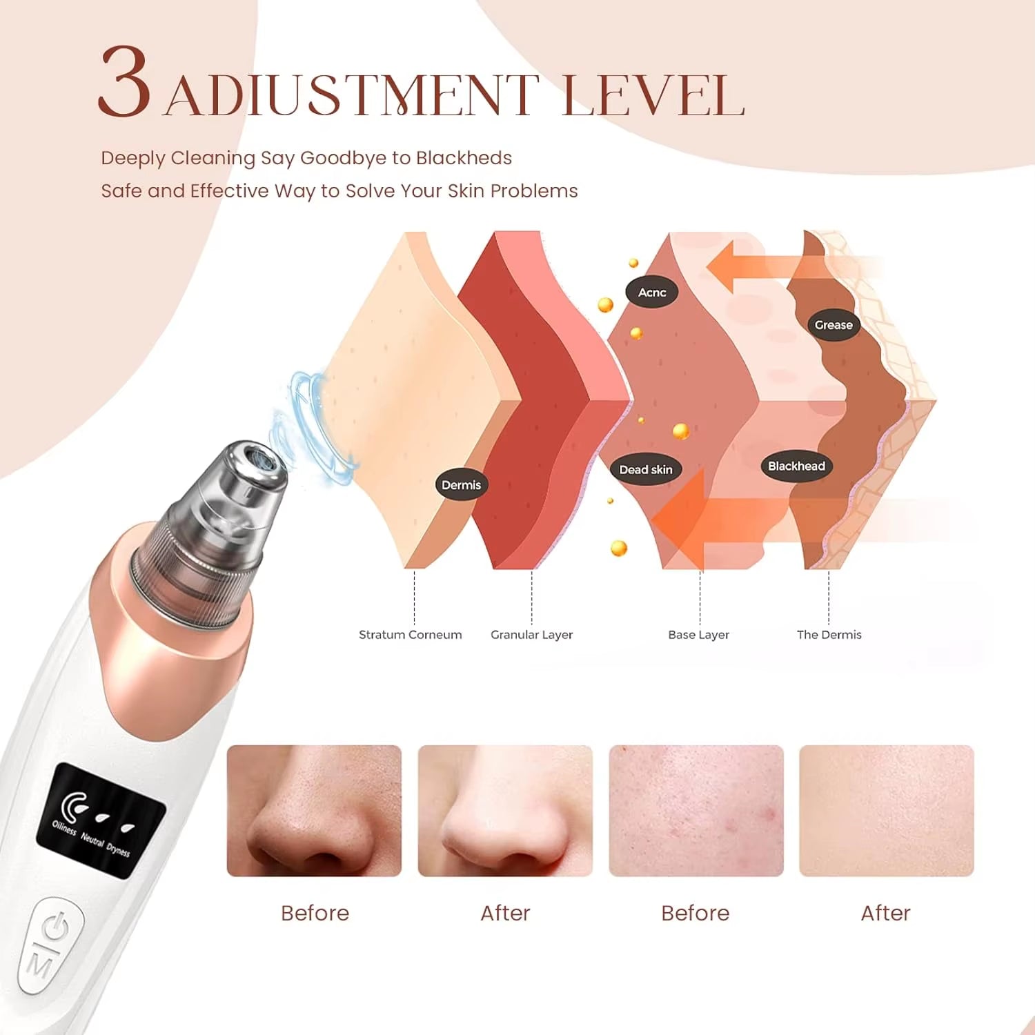 Electric Blackhead Remover Vacuum – Facial & Nose Pore Cleaner for Acne & Blackhead Extraction
