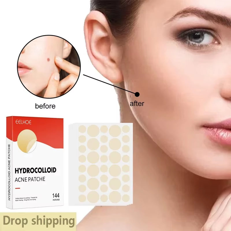 Invisible Hydrocolloid Acne Patches – Fast-Healing, Anti-Inflammatory Spot Treatment