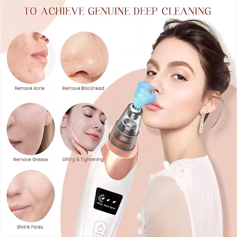 Electric Blackhead Remover Vacuum – Facial & Nose Pore Cleaner for Acne & Blackhead Extraction